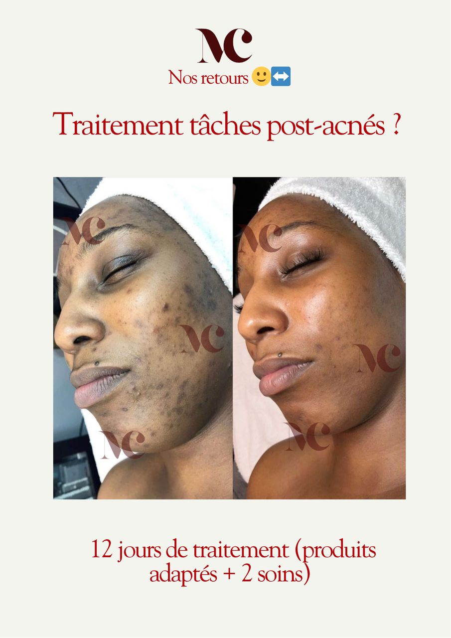 Soin visage MIA